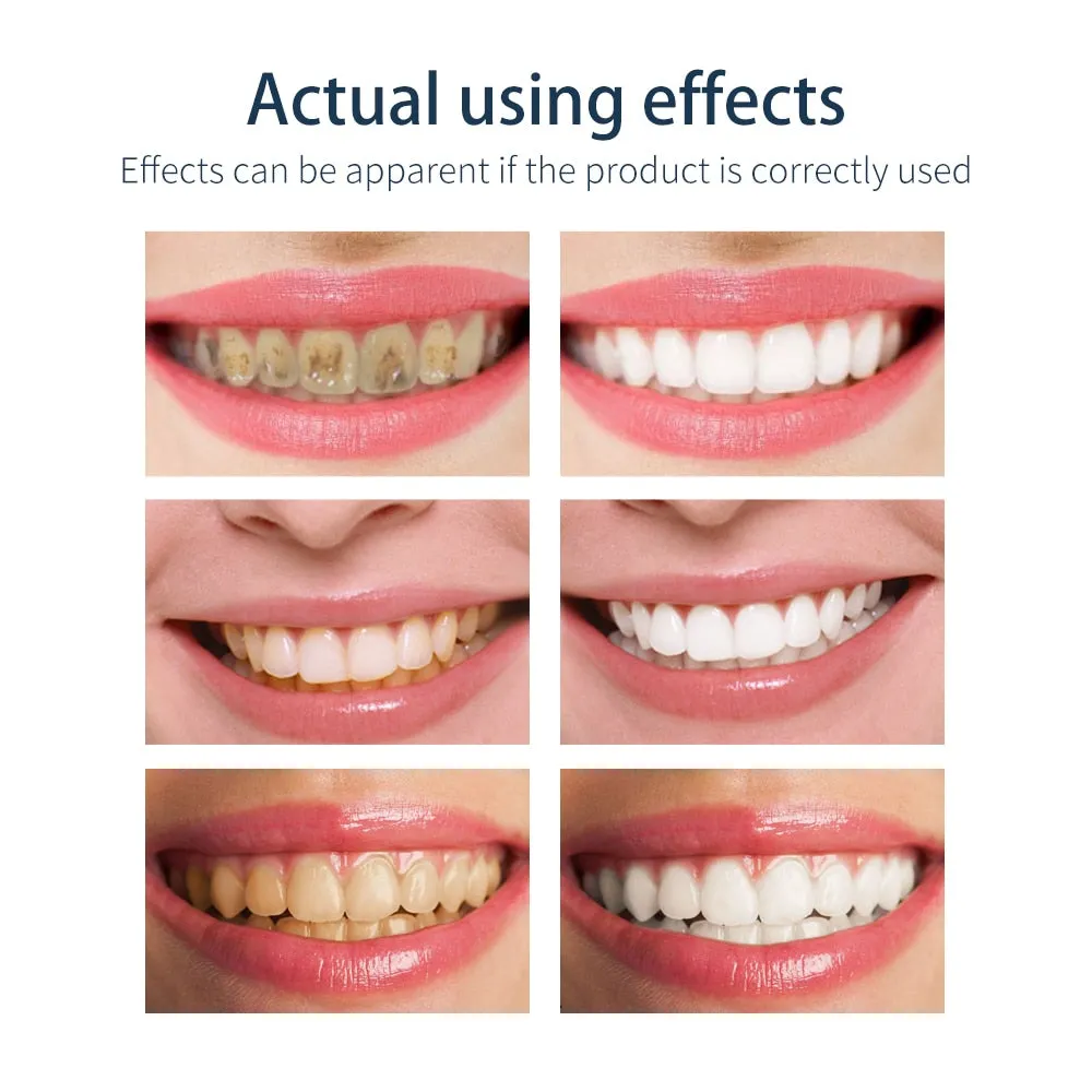 BAIMISS Fresh Shining Tooth-Cleaning Mousse Toothpaste Teeth Whitening Oral Hygiene Removes Plaque Stains Bad Breath Dental Tool